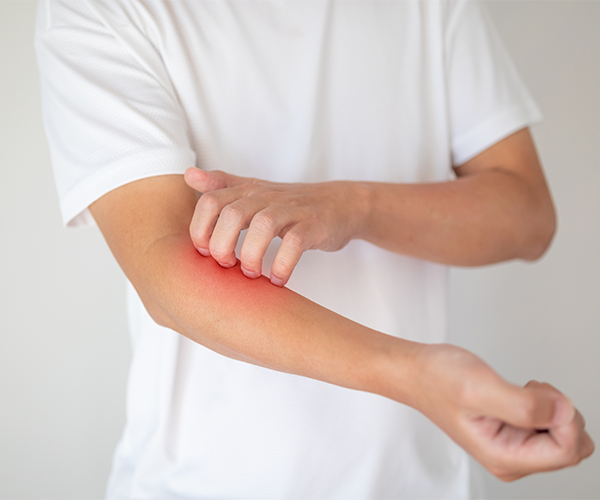 Try This Best Powder for Fungal Infection Treatment