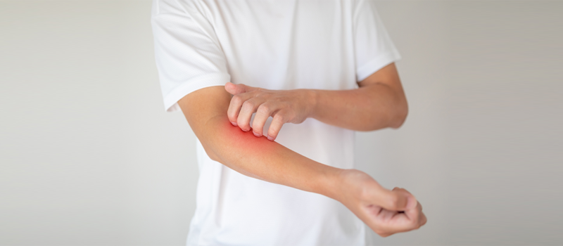 Try This Best Powder for Fungal Infection Treatment